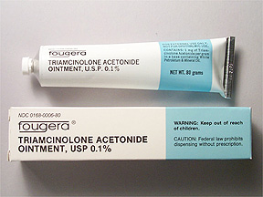 buy triamcinolone acetonide cream 5