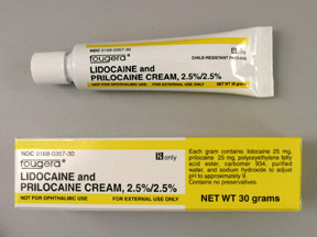 can buy lidocaine cream over counter