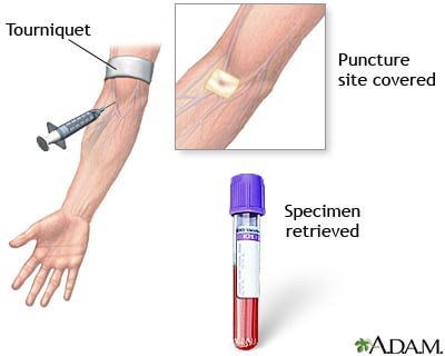 high mpv blood test and diseases