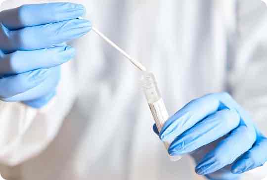 Flu testing and diagnosis
