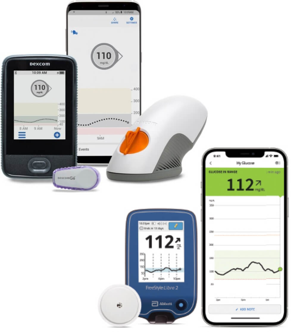 Monitoreo continuo de glucemia: el reloj inteligente que cuida tu salud 