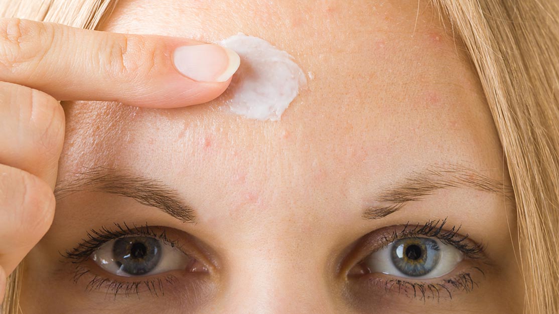 What is Cystic Acne?