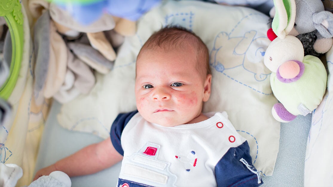 walgreens baby eczema cream